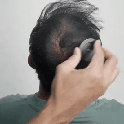 Verõnni Hair Filler